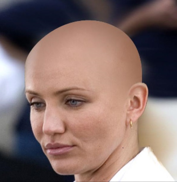 peluca estetica oncologica medea estilistas